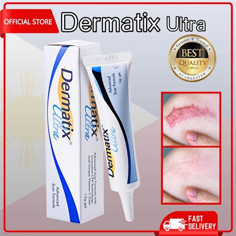 gamot sa peklat ng bata|Peklat Remover .